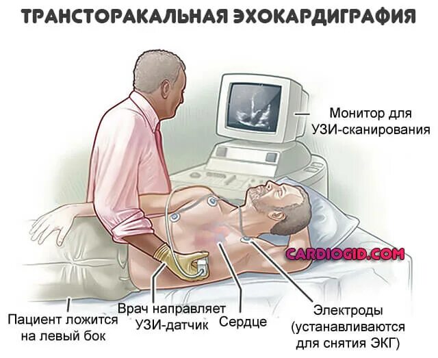 Как проходят эхо. Ультразвуковое исследование сердца - ЭХОКГ что это. Трансторакальное УЗИ сердца. Эхокардиография Эхо кг УЗИ сердца. Трансторакальная эхокардиография.