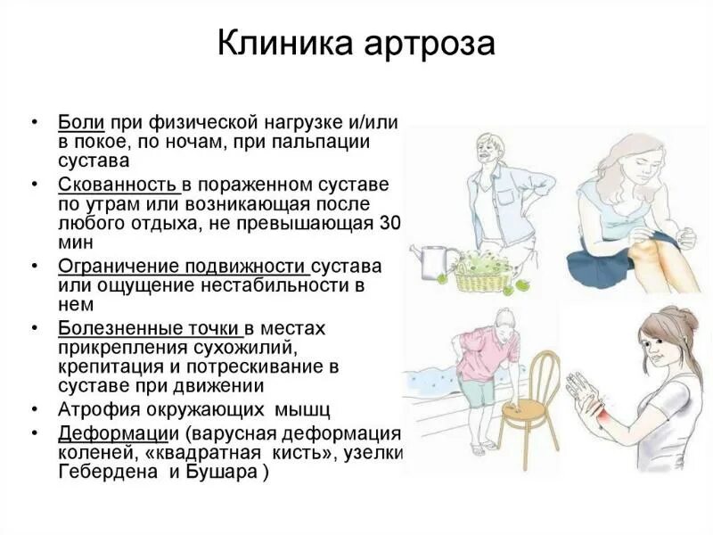 Скованность суставов по утрам причины. Ограничение подвижности в суставах. боль при физической нагрузке. скованность суставов причины. скованность суставов по утрам.