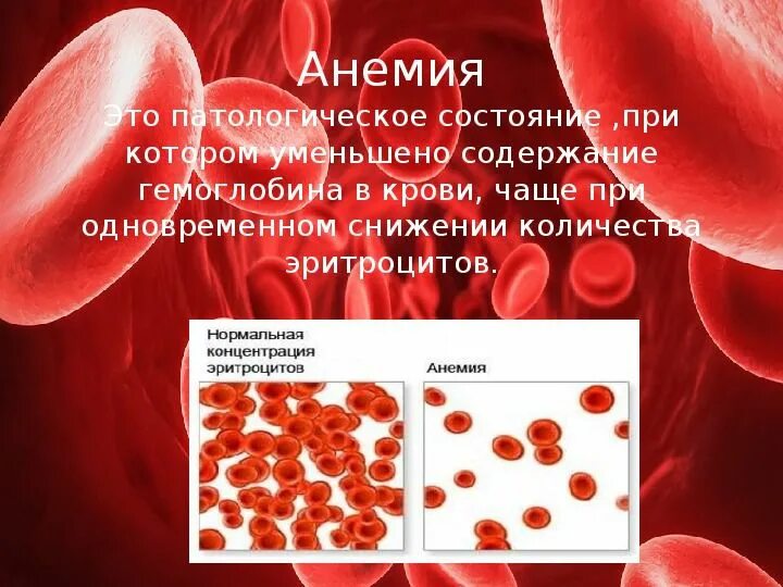 Анемия как поднять. Низкий гемоглобин. Гемоглобин в крови. Анемия гемоглобин.