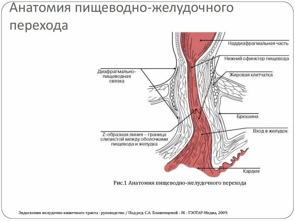Анатомия Нижнего пищеводного сфинктера. Анатомия пищеводно желудочного перехода. Нижний сфинктер пищевода анатомия. Пищевод Барретта зубчатая линия.