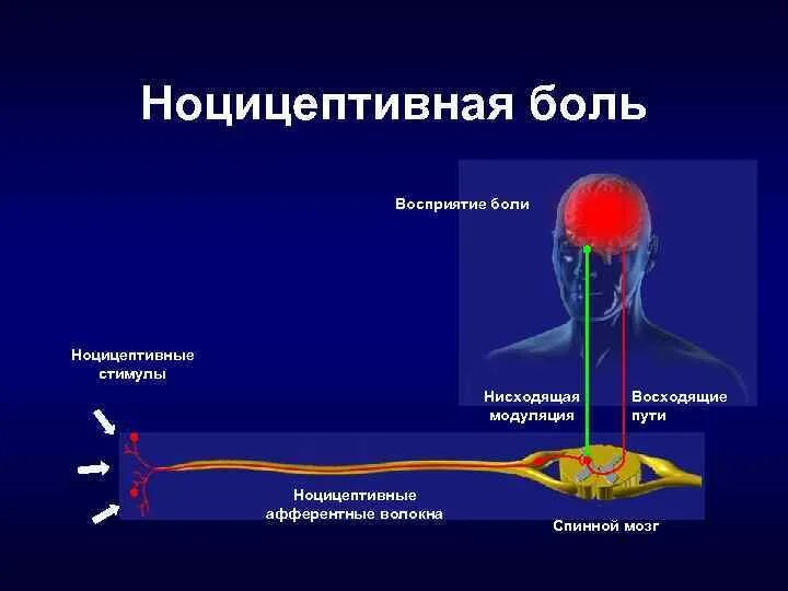 Болевая сенсорная система (Ноцицептивная система).. Ноцицептивные рецепторы строение. Болевые рецепторы ноцицепторы. Строение болевого рецептора.