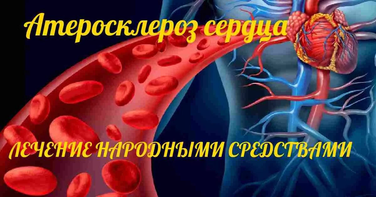 Сосуды эффективное лечение. Атеросклероз народная медицина. Атеросклероз сосудов головного мозга. Атеросклероз сосудов народные средства. Церебральный атеросклероз.