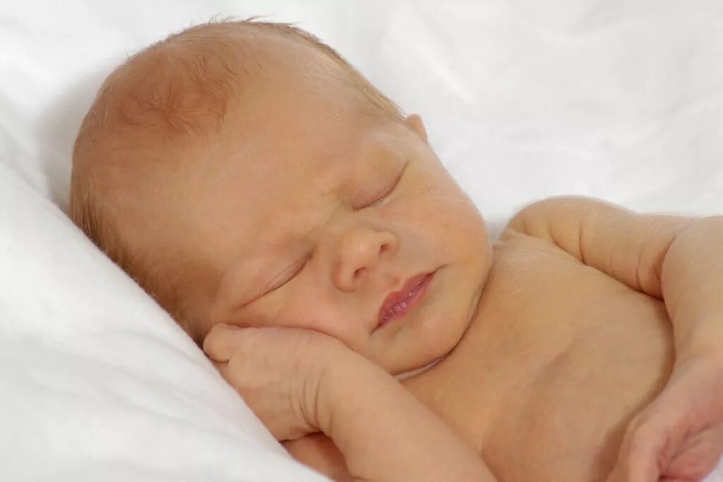 Желтушка у новорожденных. Физиологическая желтуха новорожденных. Желтуха новорожденных отзывы