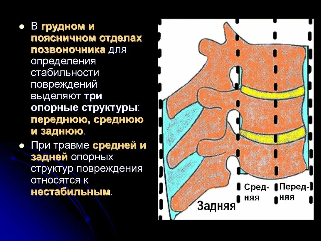 Травма поясничного отдела позвоночника. Передний опорный комплекс позвоночника. Передние и задние структуры позвоночника. Задний отдел позвонка. Опорные структуры позвонка.