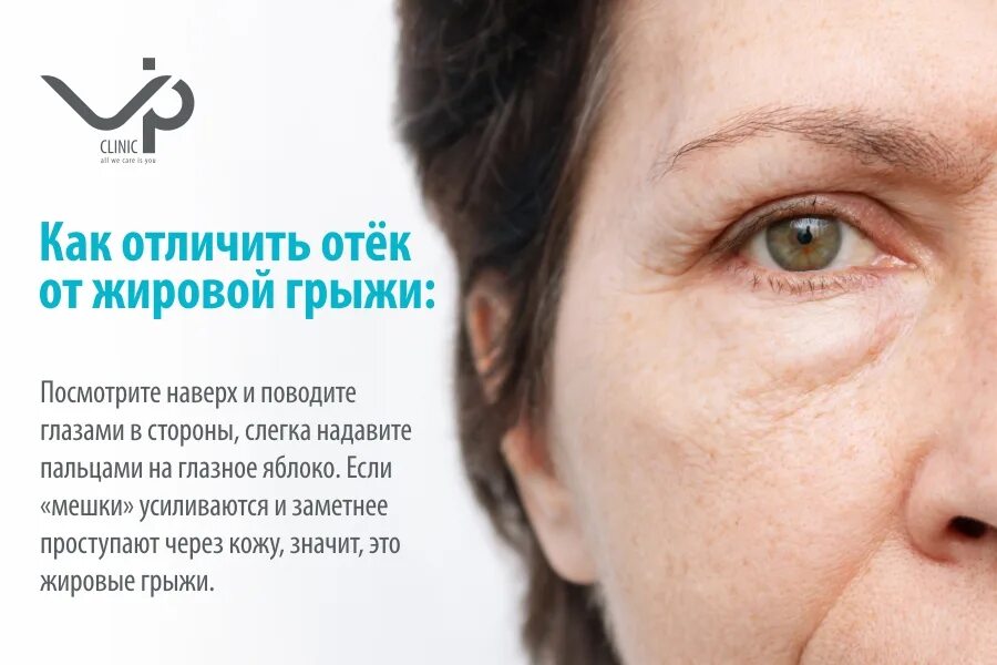 Как быстро снять отек вокруг глаз Как снять отек после слез быстро и эффективно дома