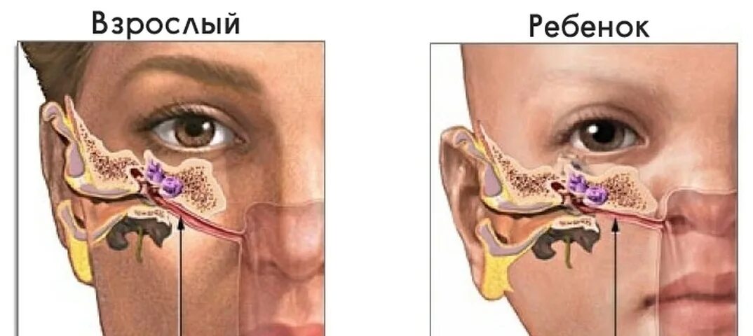 Заложенность уха тубоотит. Евстахиева труба анатомия человека. Евстахиева труба и носоглотка. Евстахиит воспаление слуховой трубы. Воспаление и закупорка слуховой евстахиевой трубы.