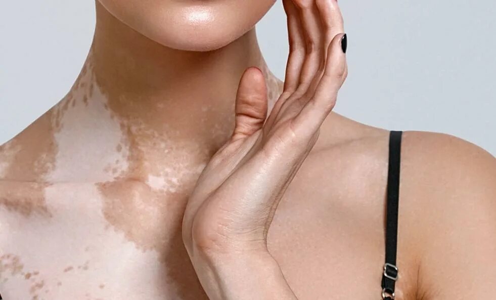 How to get white skin. Лифтинг кожи. Estatic white skin. Подтянутая кожа лица. Мероприятие свежая и чистая кожа.