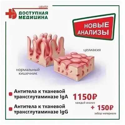 Анализ антитела к тканевой трансглутаминазе