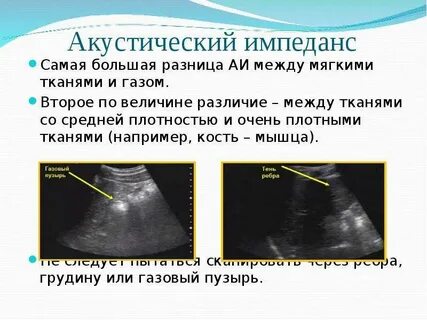 Между мягкими