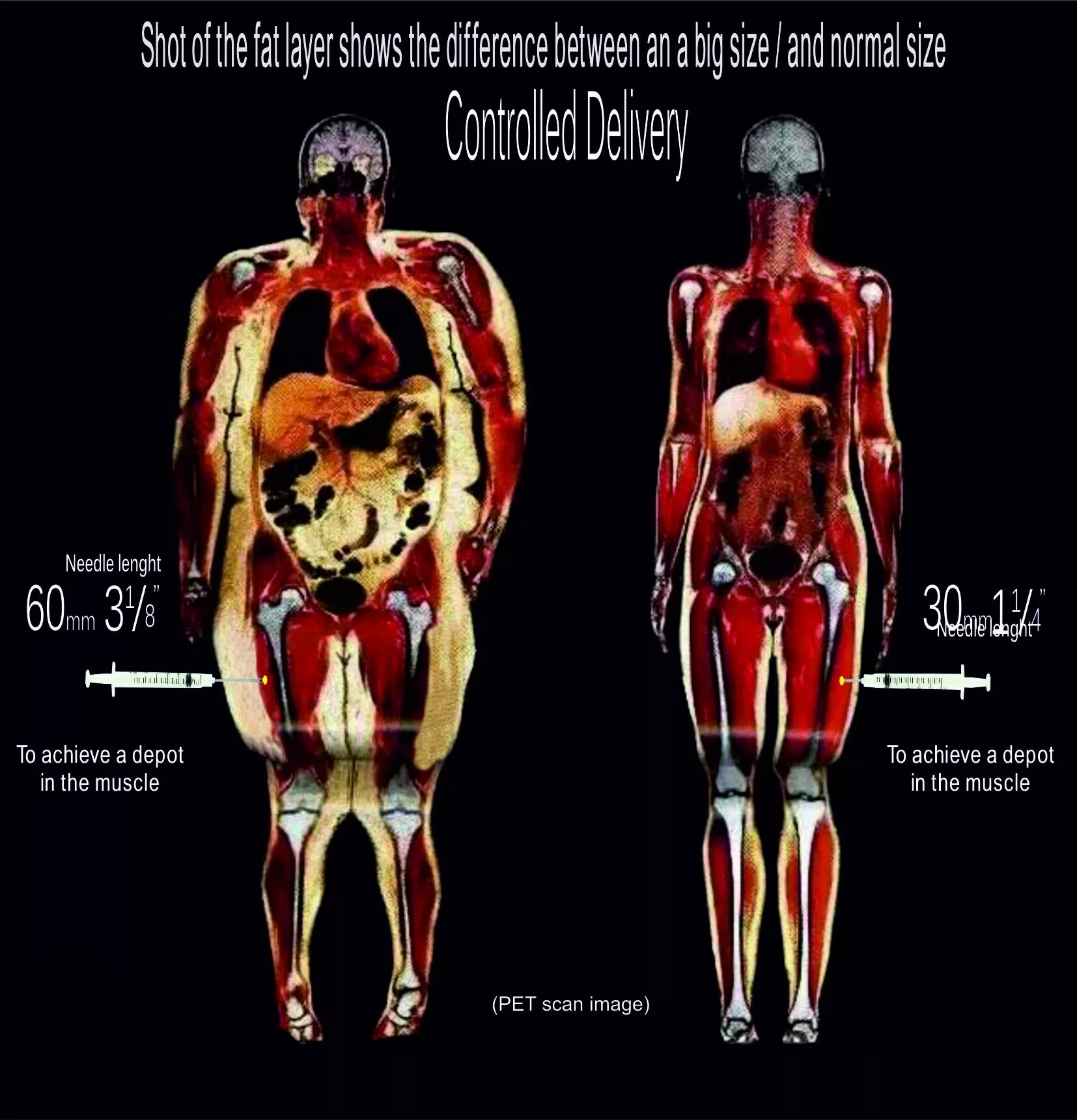 Рентген человека с ожирением. Рентген человека. Широкая кость в медицине.
