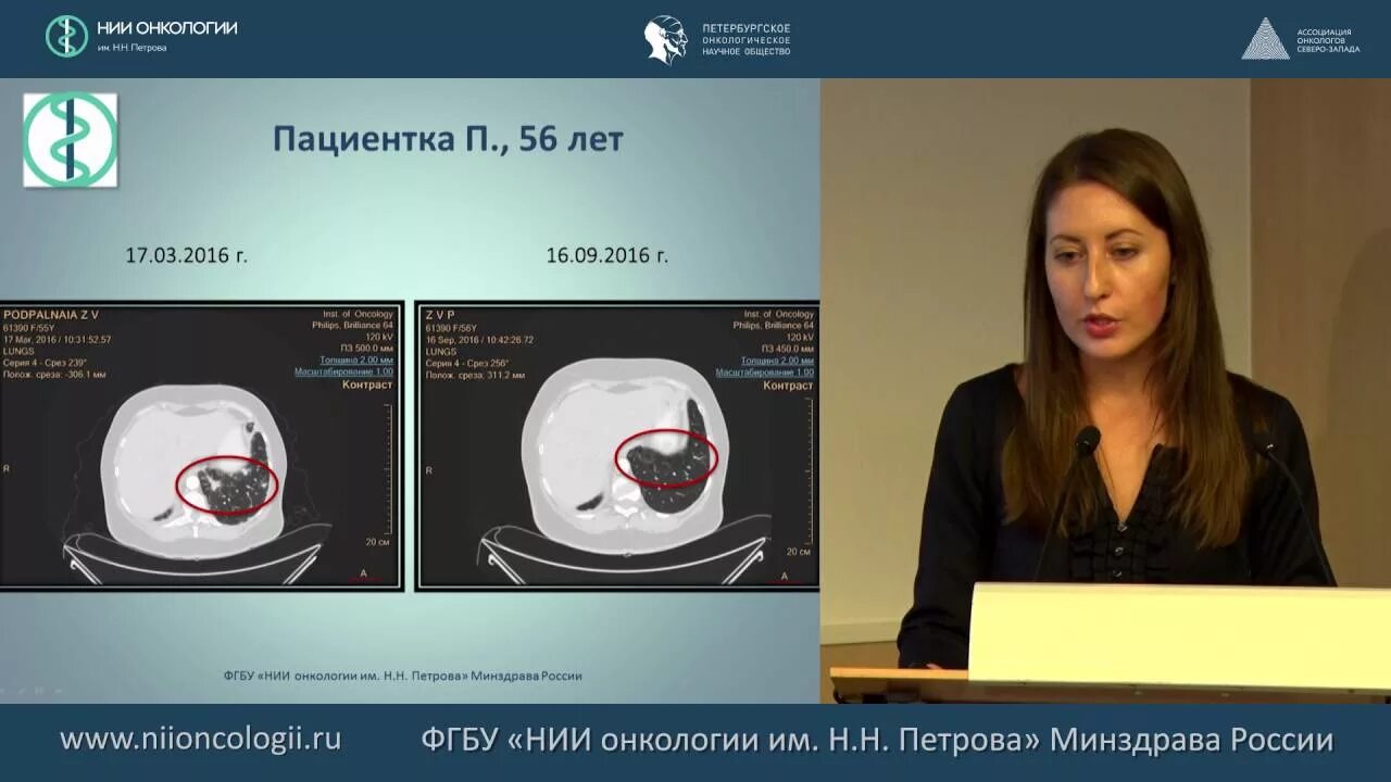 Вакцина от рака институт петрова. НИИ онкологии Петрова Санкт-Петербург. Н Н Петрова онкология Санкт-Петербург. НМИЦ онкологии Петрова. НИИ Петрова фото.