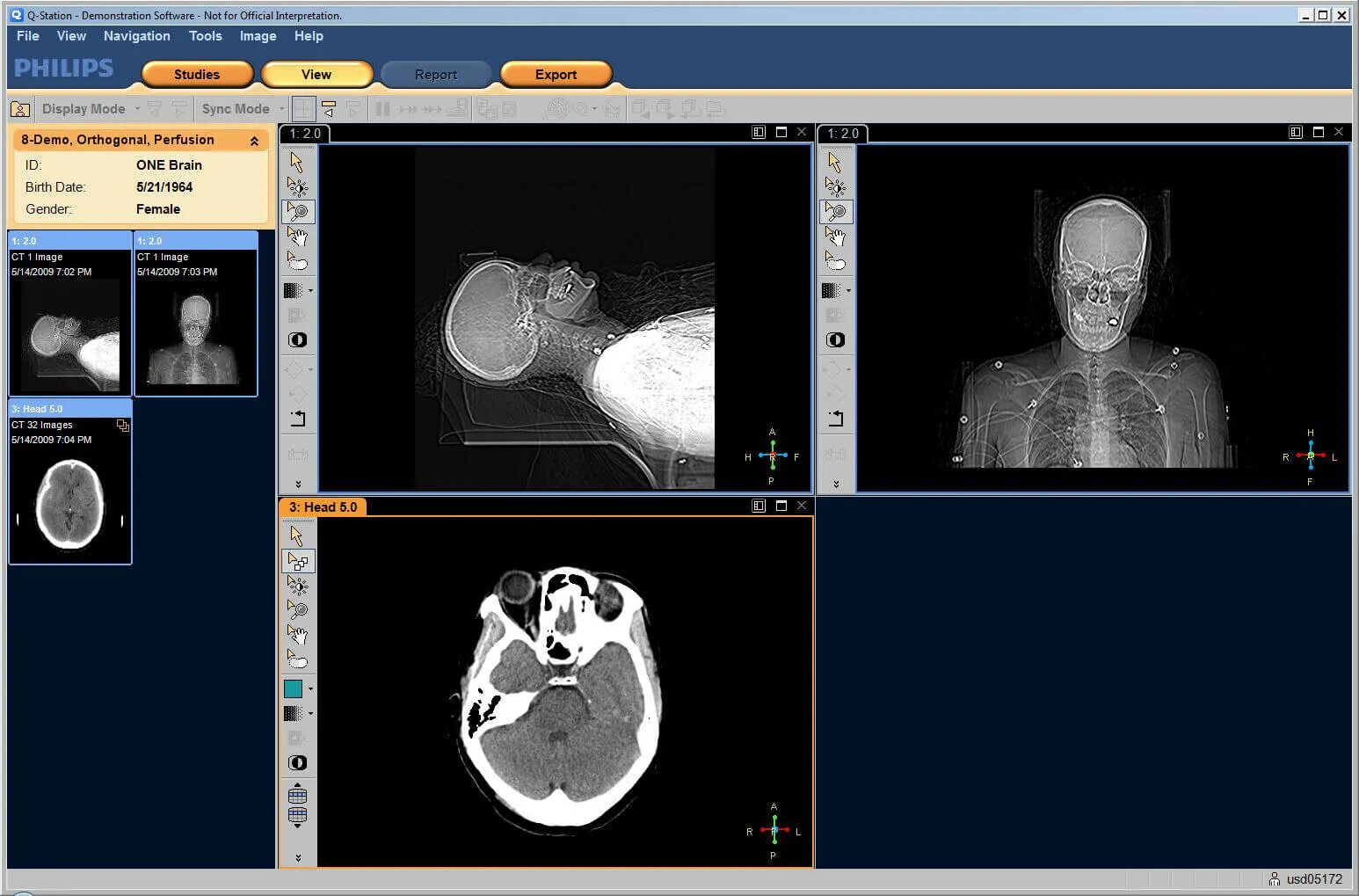 Dicom viewer. Philips dicom viewer r3.0. изображение dicom. dicom 3.0. программным пакетом dicom.