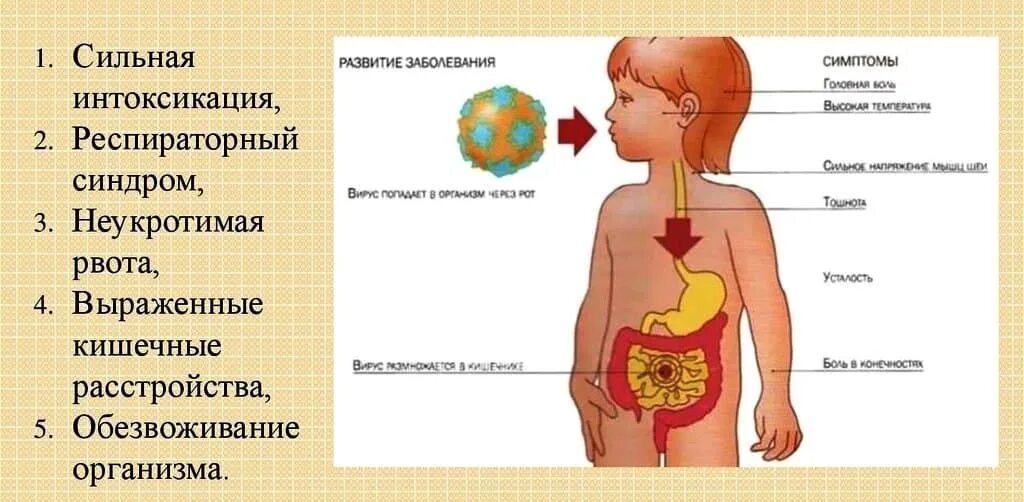 Ротавирус сколько дней заразен. Ротавирусная инфекция презентация. Симптомы ротавируса у детей. Ротавирусная инфекция у детей симптомы.