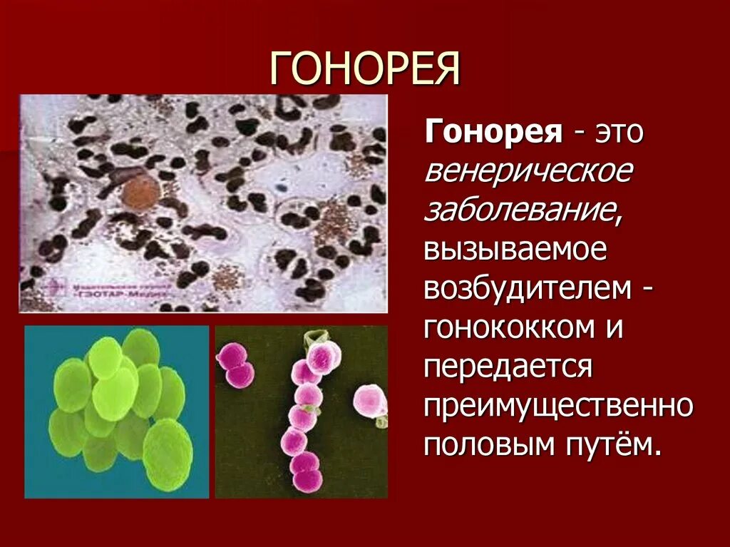 Гонококки хламидии. Возбудитель гонококковой инфекции. Гонококки возбудитель заболевания. Венерические заболевания презентация.