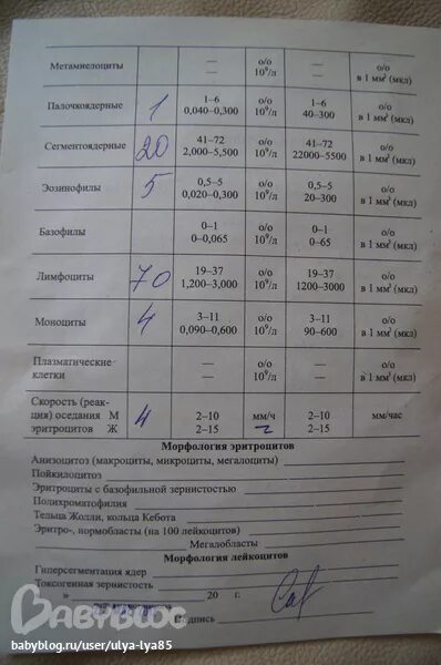 Нужно сдавать анализы перед прививкой. Анализы для ревматолога. Какие анализы нужно сдать. Какие анализы сдать ребенку. Какие анализы сдать перед прививкой.