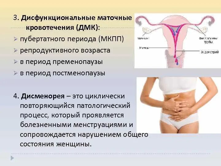 Кровотечение вне цикла причины. Маточные кровотечения в репродуктивном периоде. Дисфункциональное маточное кровотечение репродуктивного периода. Аномальные маточные кровотечения. Овуляторные дисфункциональные кровотечения.