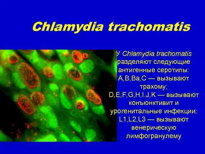 Chlamydia trachomatis