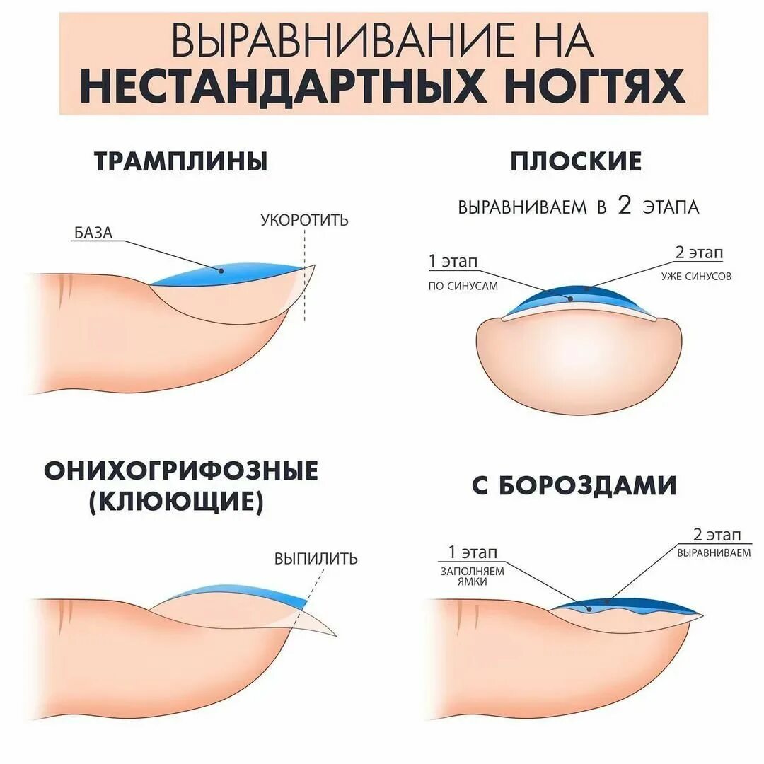 Как правильно выравнивать ногти базой. Схема выравнивания ногтевой пластины базой. как выравнивание ногтевую пластину базой. схема выравнивания ногтевой пластины гелем. выравнивание ногтевой пластины базой.