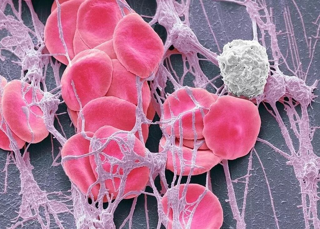 В12 дефицитная анемия мазок. Эритроциты. Норма витамина в12 в анализе крови у детей. В12 дефицитная анемия в клиническом анализе. Витамин в12 тромбоциты.