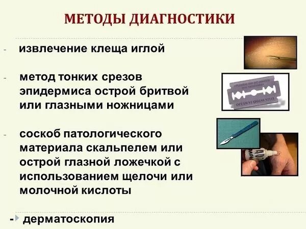 Одним из критериев диагностики чесотки является. Чесотка метод диагностики. Чесоточный зудень диагностика. Лабораторная диагностика чесотки. Лабораторная диагностика чесотки.