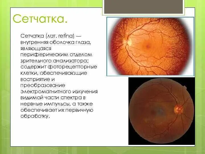 Внутренняя оболочка глаза сетчатка. Отделы сетчатки глаза. Периферический отдел сетчатки. Частями сетчатой оболочки глаза являются.