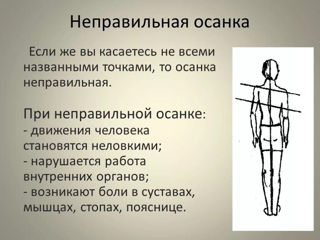 Стать осанка. Неправильная осанка. при неправильной осанке. неправильная осанка осанки. человек с неправильной осанкой.