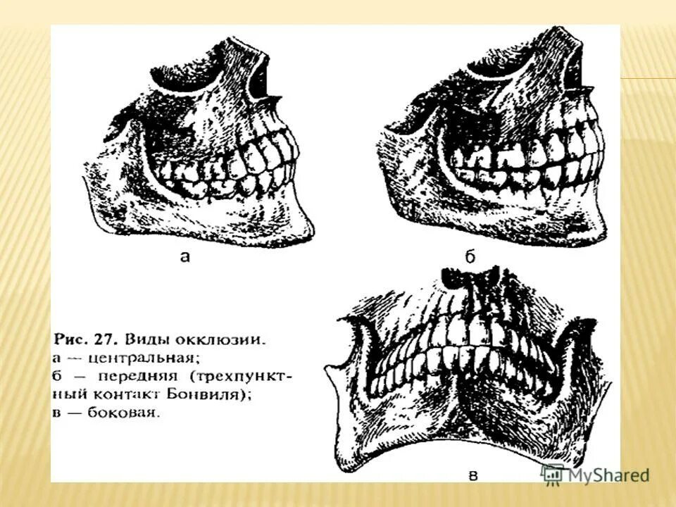 Окклюзия челюсти боковая. Артикуляция окклюзия прикус. Центральная окклюзия вид сбоку. Зубы в центральной окклюзии. Артикуляция зубов