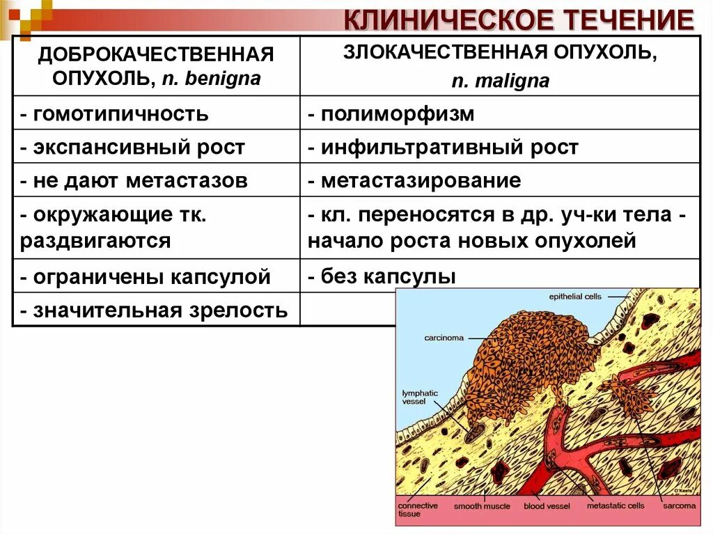 Доброкачественные и злокачественные опухоли. Как отличить злокачественную опухоль. Доброкачественная опухоль и злокачественная опухоль. Клиническое течение доброкачественных опухолей. Как отличить доброкачественную от злокачественной