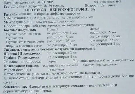Нейросонография у взрослых