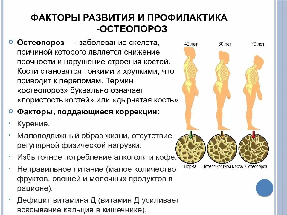 Профилактикой развития болезней. Остеопороз. Причины развития. Проявления. Профилактика. Остеопороз причины. Предупреждение развития остеопороза. Профилактика развития остеопороза.