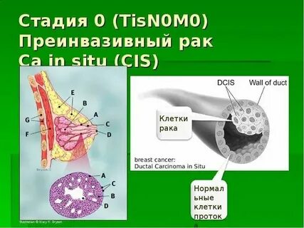 Рак сито