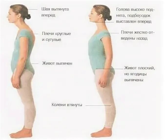 Как сделать плечи меньше. Сутулость у подростка причины и лечение. не покатые плечи. как должны выглядеть лопатки при правильной осанке. как сделать тонкие плечи.