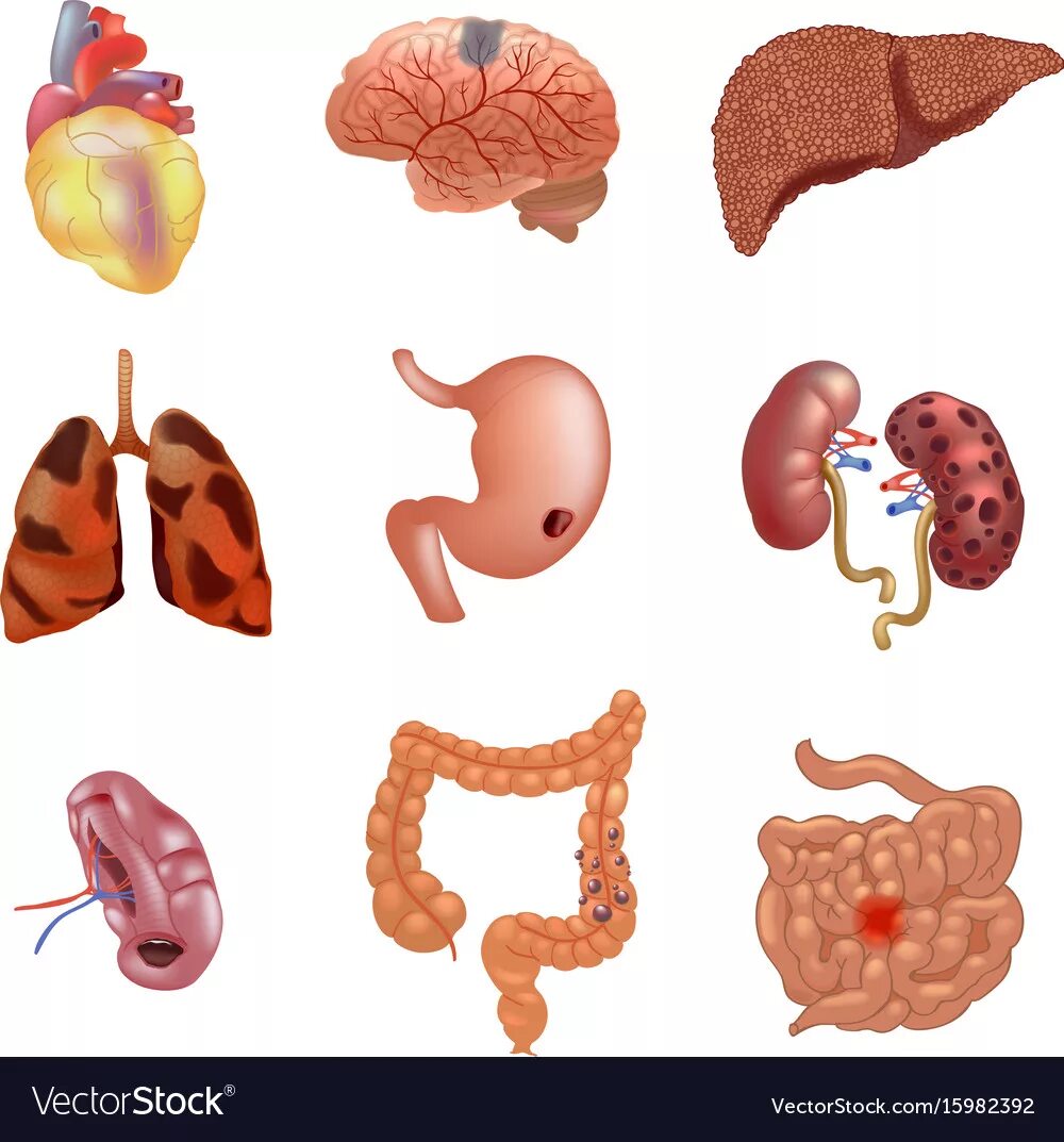 Отдельные органы человека. Здоровые внутренние органы человека. Больные внутренние органы. Органы нездорового человека. Внутренние органы больного человека.