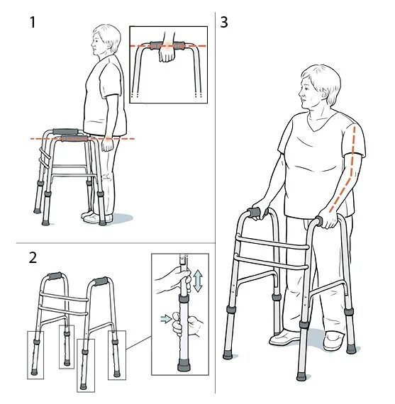 Стул после эндопротезирования. Для инвалидов приспособления для ходьбы ходунки для пожилых. Ходунки для инвалидов с ампутированной ногой. Ходунки алгоритм пользования. Приспособьен я дя хотдьбы.
