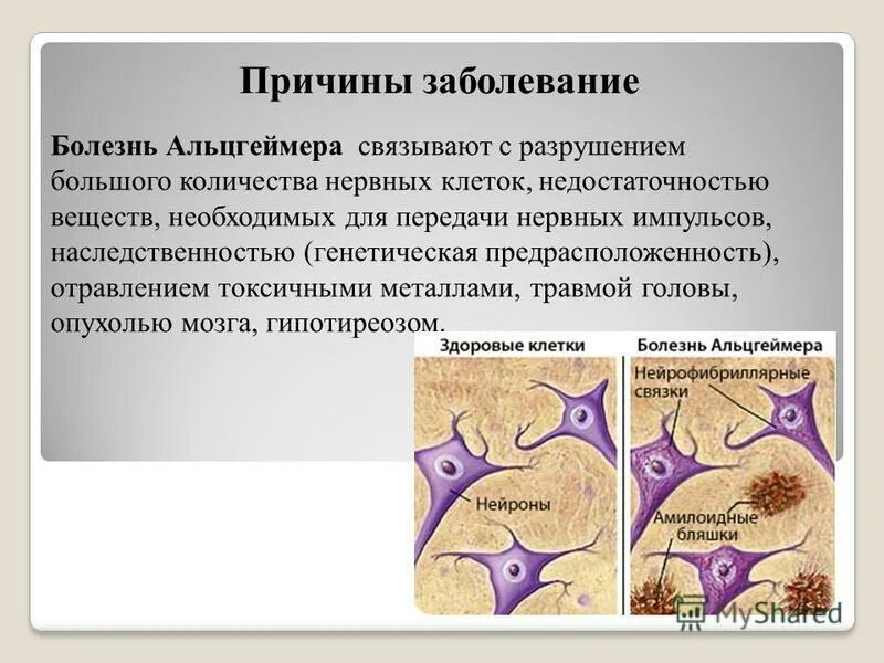Передается ли альцгеймер по наследству