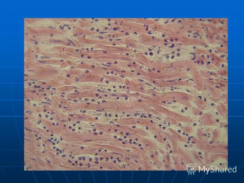 темы по патологической анатомии