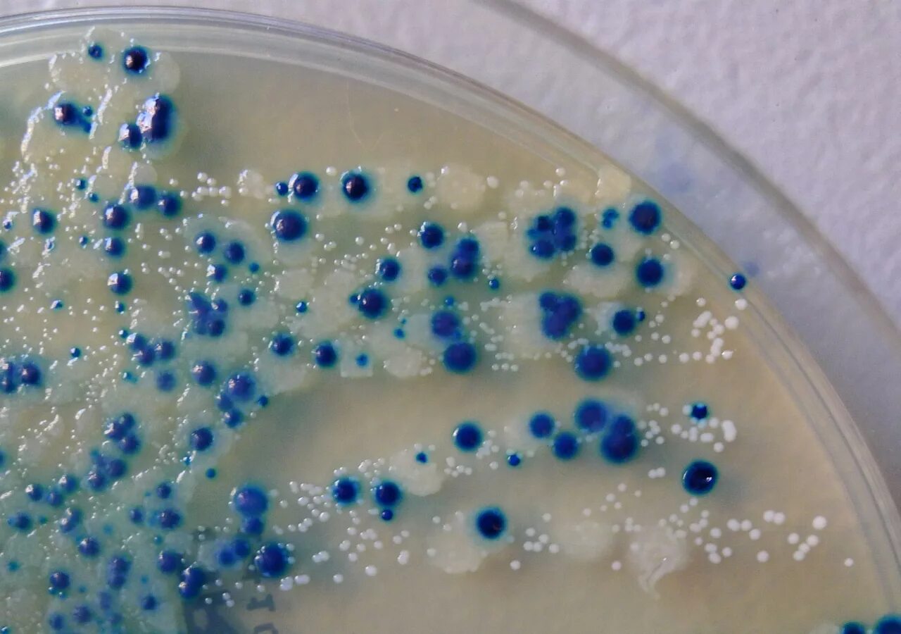 Красивые бактерии. Самая опасная бактерия в мире. Самые опасные бактерии. Бактерии клостридиум ботулинум. Самые опасные бактерии.