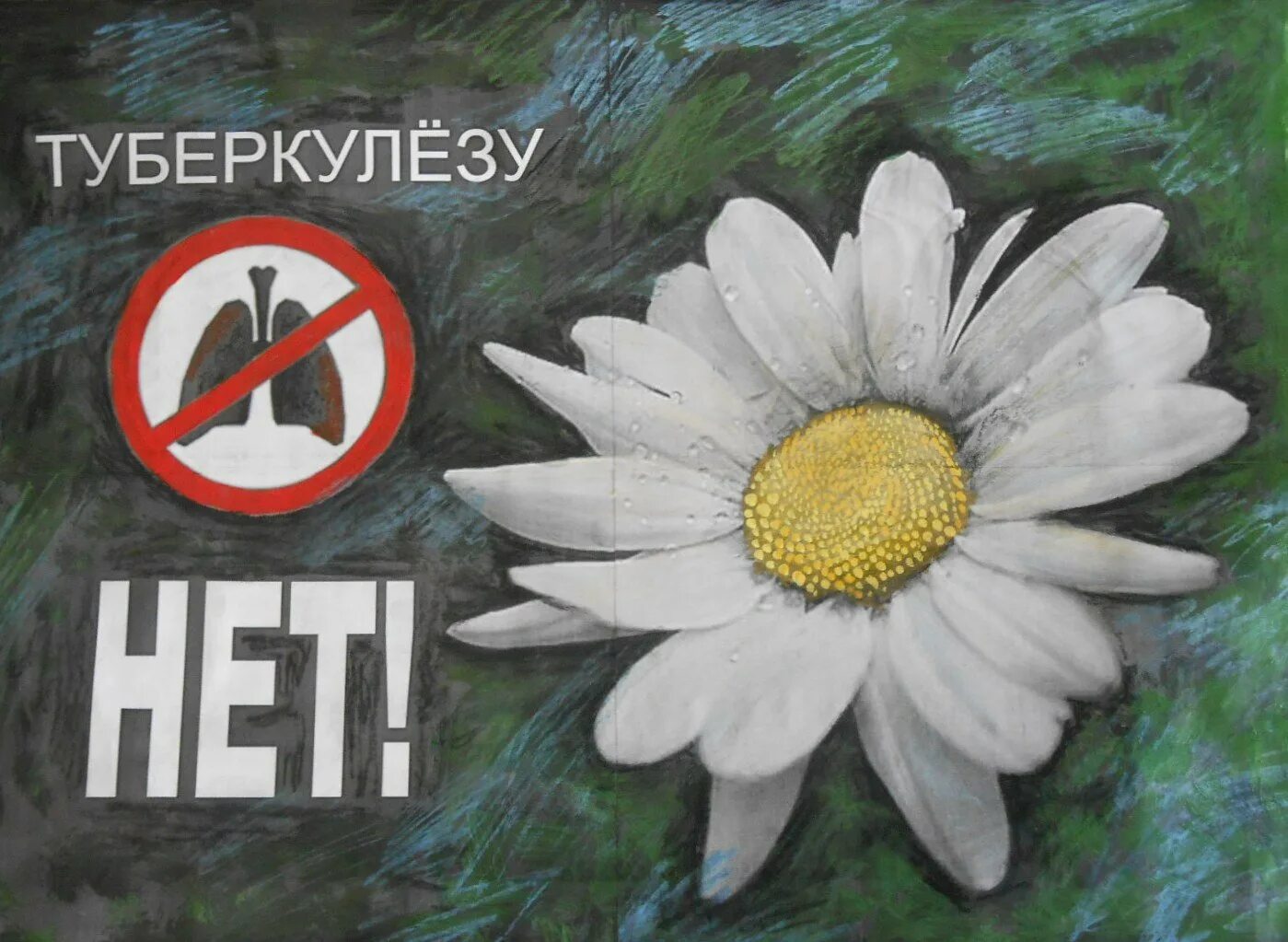 Ромашка против туберкулеза. Борьба с туберкулезом. Символ борьбы с туберкулезом. Символ Ромашка день борьбы с туберкулезом. Ромашка борьба с туберкулезом.