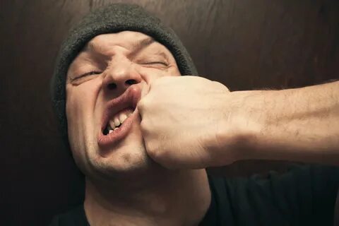 Если на работе дали по лицу