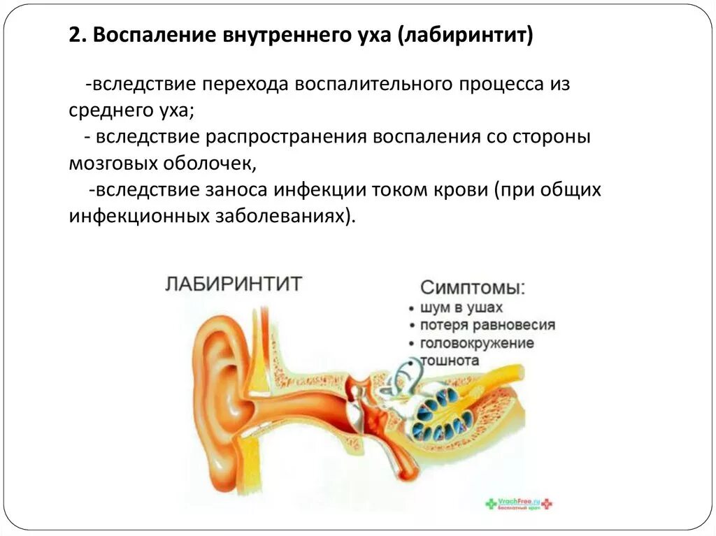 Воспаление внутреннего уха лечение