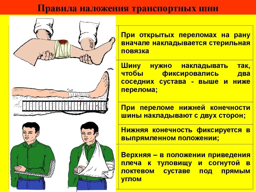 Основные правила наложения шин при переломах