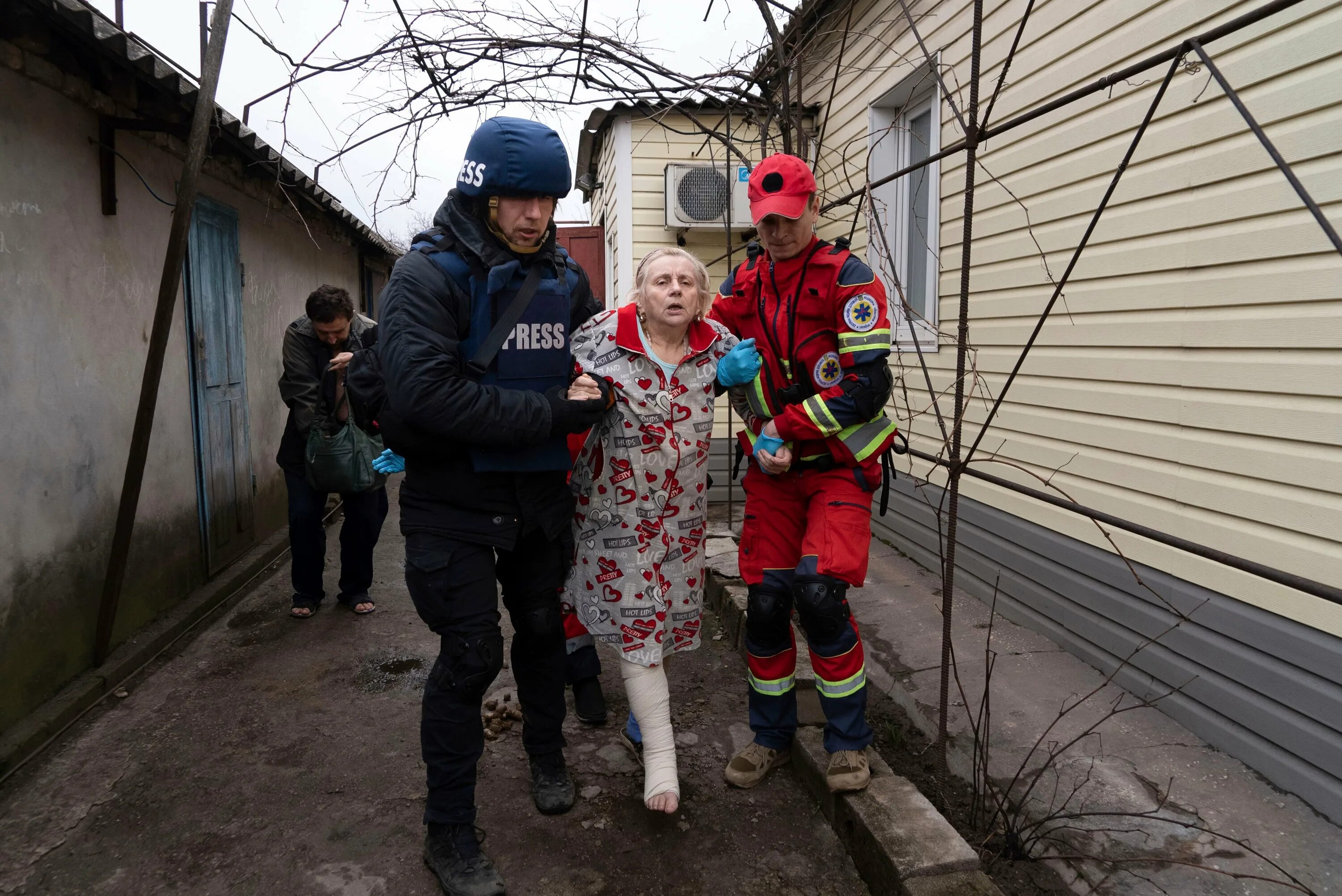 Раненые дети в Мариуполе. Мертвые украинские дети. Раненые дети войны на Украине.