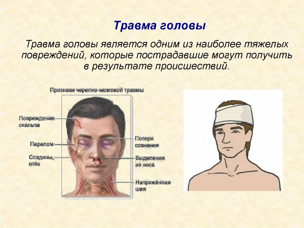 Голова трава. Травмы черепа и головного мозга. Больной с чмт