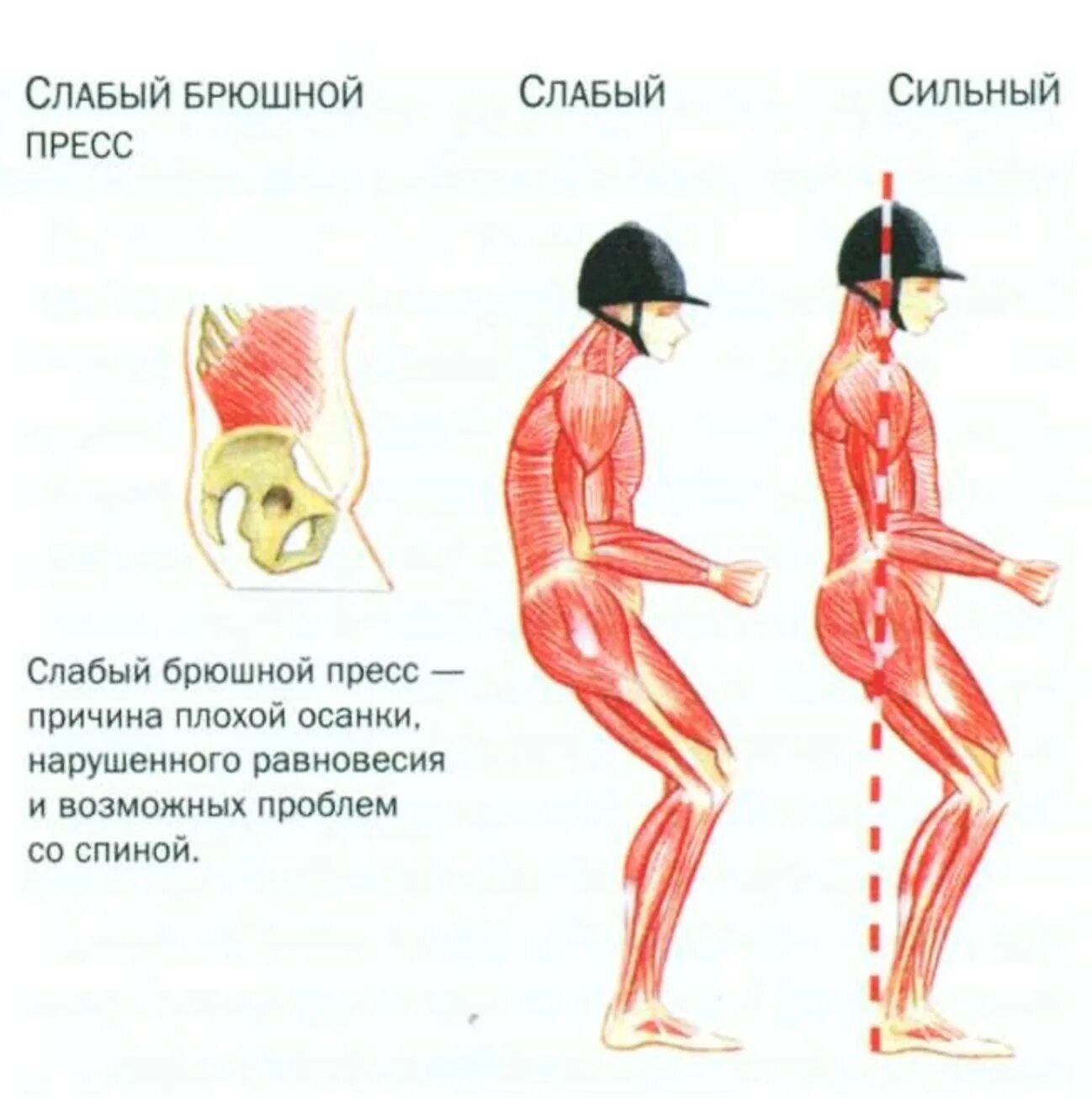 Слабые мышцы. Мышцы спины для осанки. Слабые мышцы спины. Мышцы поясницы. Тонус поясницы