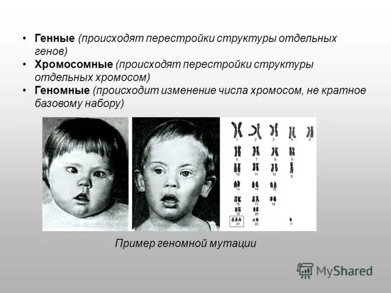 Хромосомные мутации выпадающие. Аномалии числа хромосом и нарушения структуры хромосом. хромосомные и геномные мутации болезни. наследственные болезни хромосомные мутации. геномные мутации хромосомы.