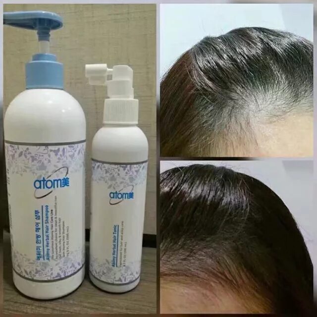 Шампунь Хербал Atomy. Atomy Herbal hair Shampoo шампунь. Спрей против выпадения волос Atomy. Atomy Saengmodan hair Tonic. Спрей от выпадения волос атоми