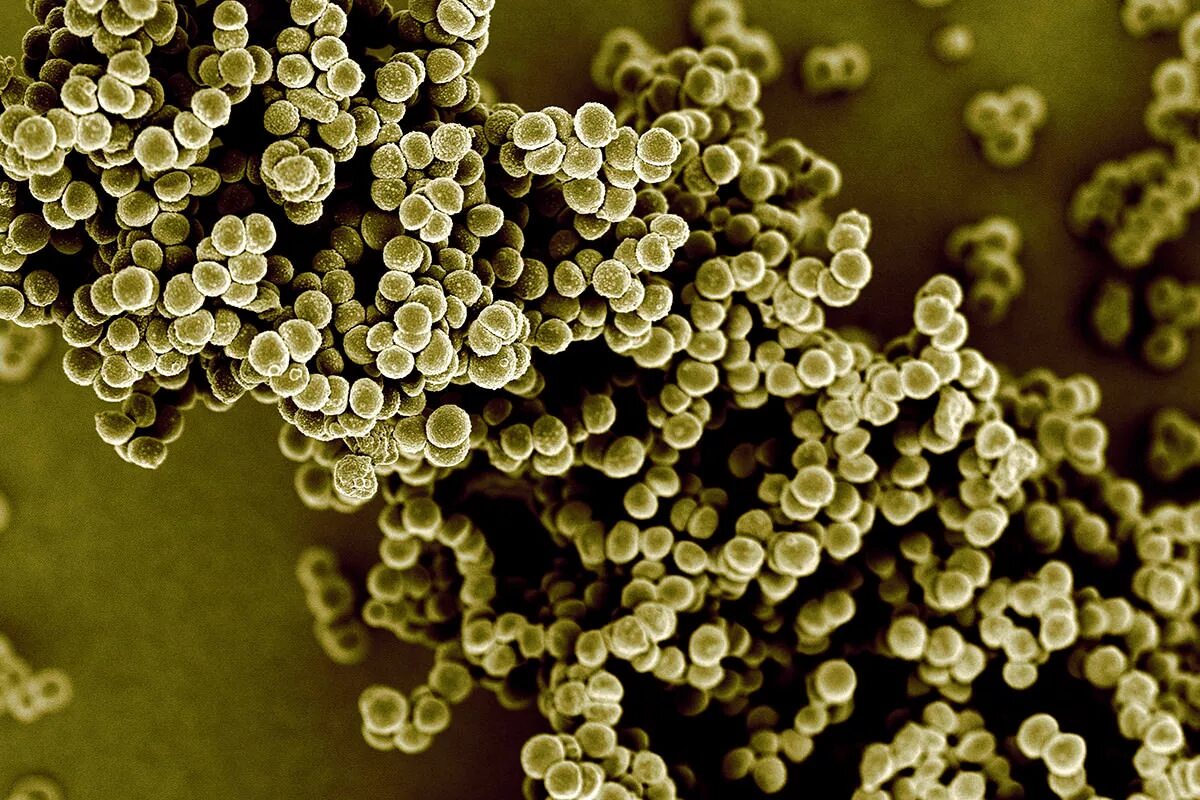 Зеленящий стафилококк. Aureus золотистый стафилококк. Золотистый стафилококк под микроскопом. Стафилококкус ауреус. Золотистый стафилококк ауреус под микроскопом.