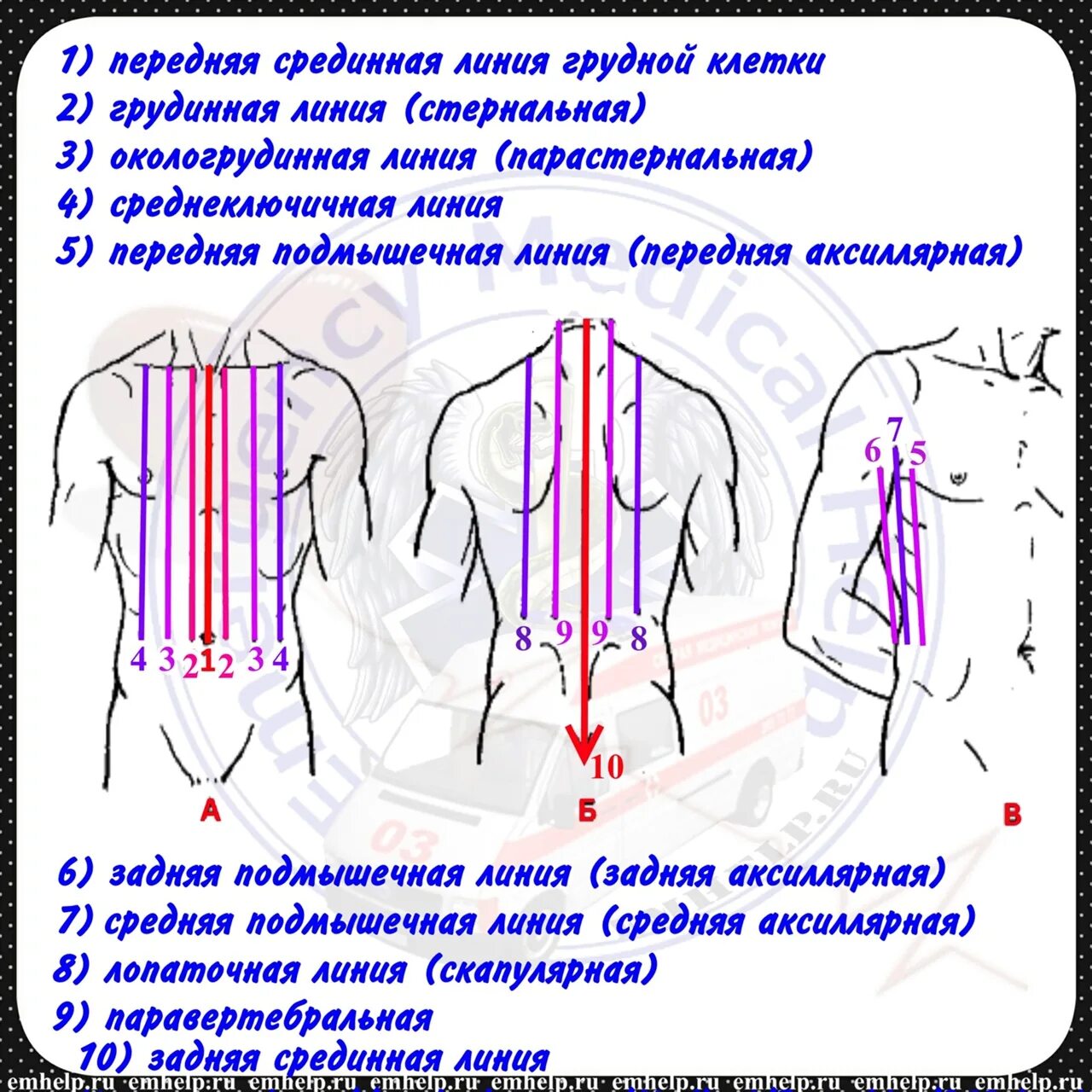 Где эти 3 линии. Топографические линии грудной клетки 10 линий. Топографические линии грудной клетки пропедевтика. Задняя аксиллярная линия грудной клетки. Грудная клетка спереди топографические линии.