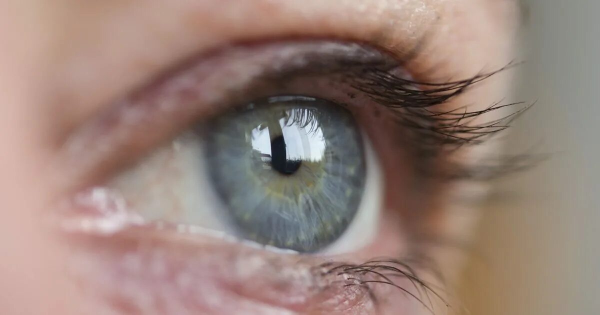 Сухость глаза (ксерофтальмия). Глазки сухо