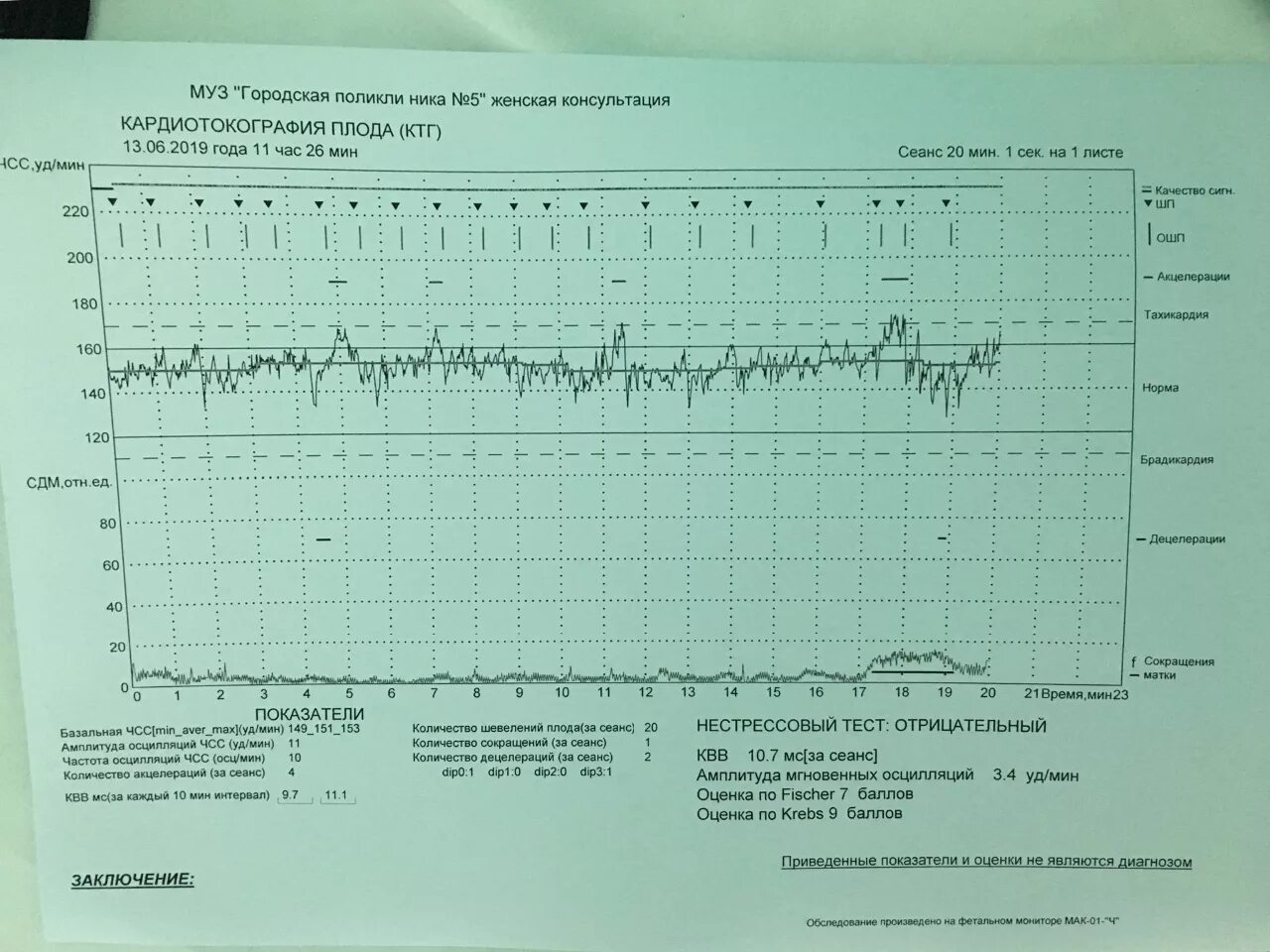 Нормы по КТГ В 35 недель беременности. Нормальная диаграмма КТГ. КТГ-мониторинг алгоритм.